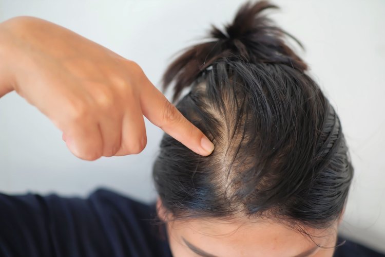 Natural Ways to Regrow Thinning Hair